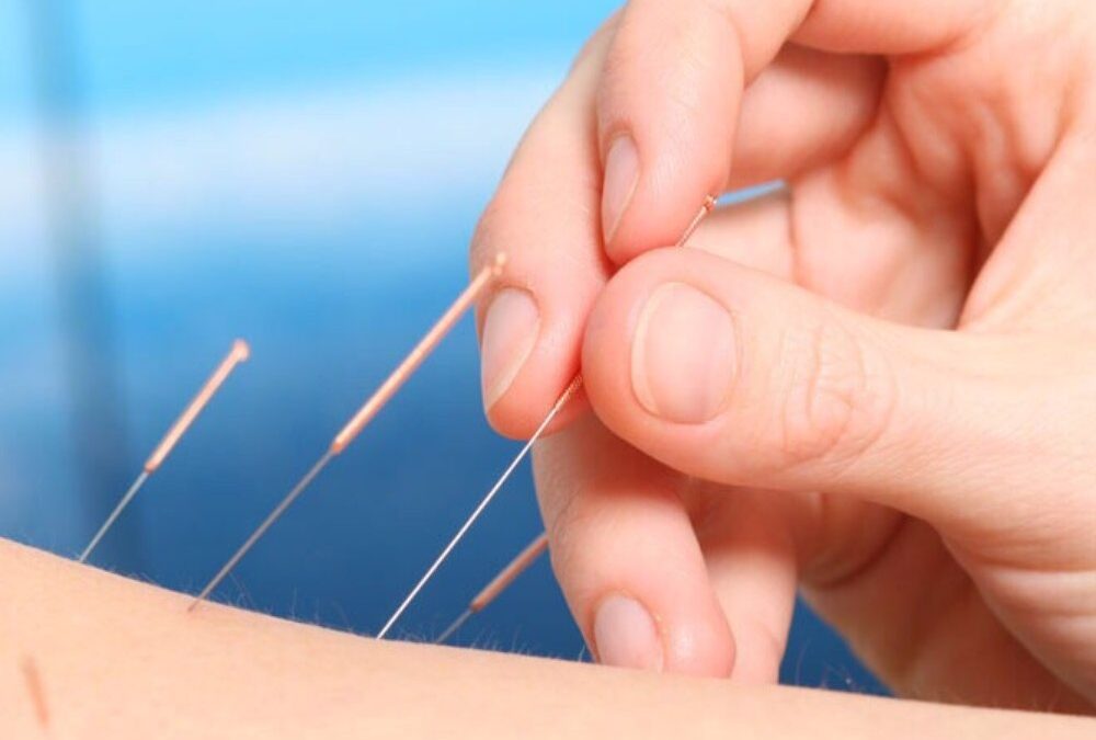 The Path to Wellness Through Acupuncture with Kirby Woods