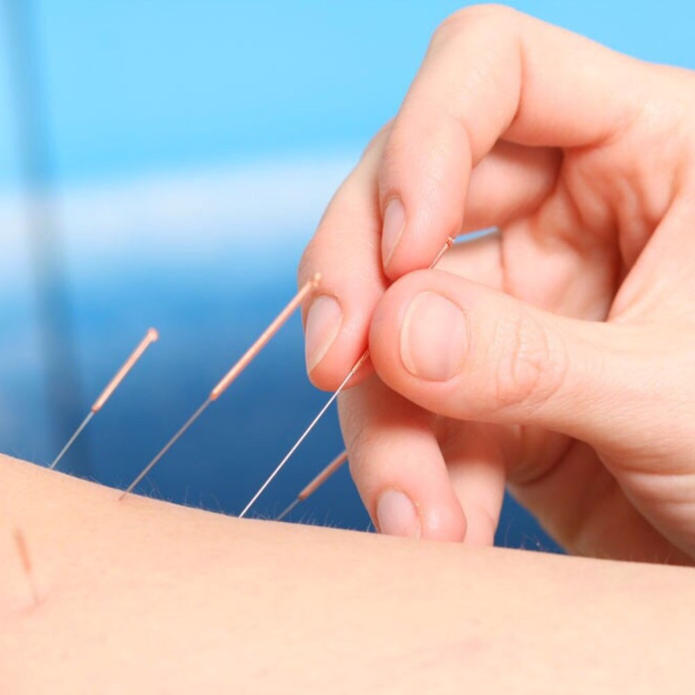 The Path to Wellness Through Acupuncture with Kirby Woods